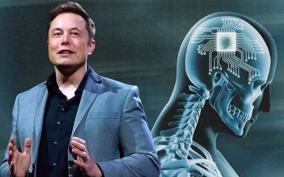 Neuralink de Elon Musk / Neuralink fez implante